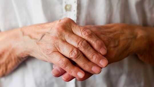 rheumatoid arthritis sebagai penyebab nyeri pada persendian jari