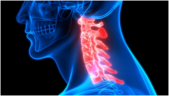 sakit leher menyebabkan sakit punggung