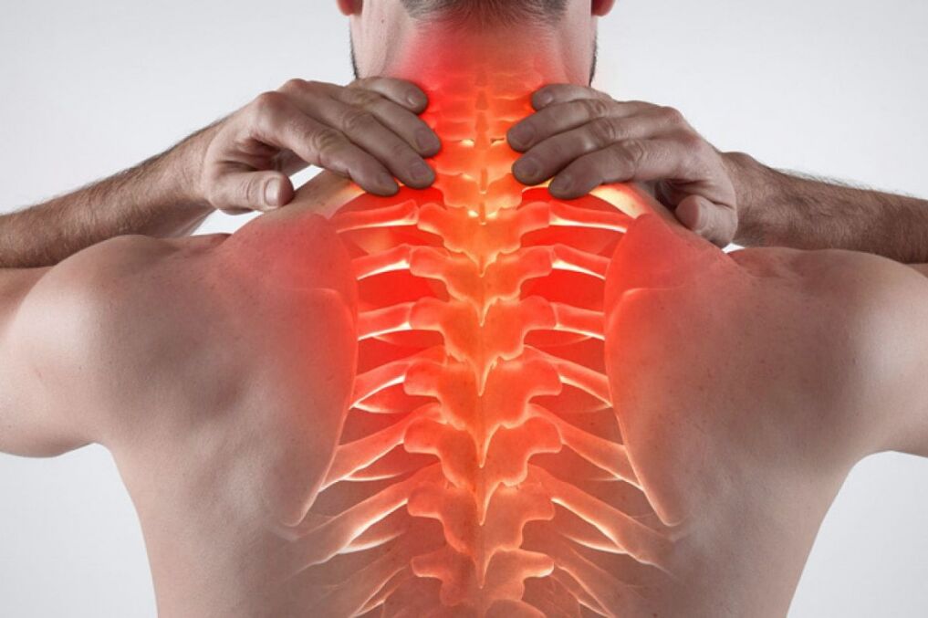 Osteochondrosis pada tulang belakang dada