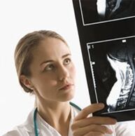Diagnosis osteochondrosis ditentukan menggunakan pemeriksaan x -ray