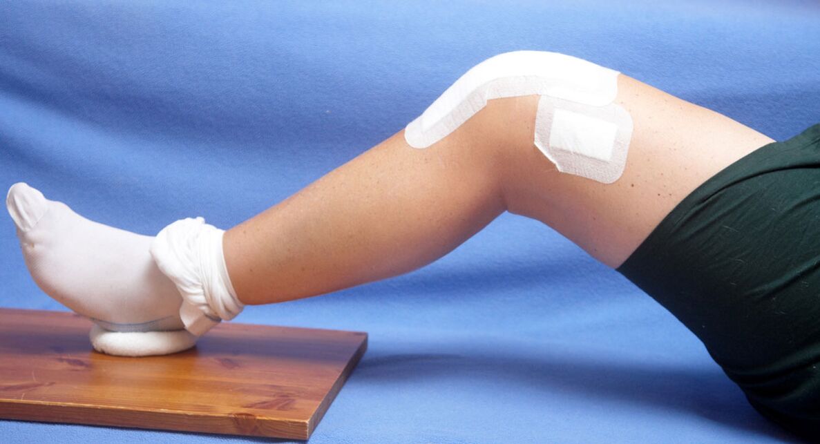 arthrosis pengobatan sendi lutut