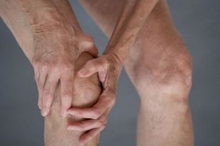 tanda dan gejala arthrosis lutut